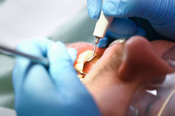Professional Emergency Dental Service in WV