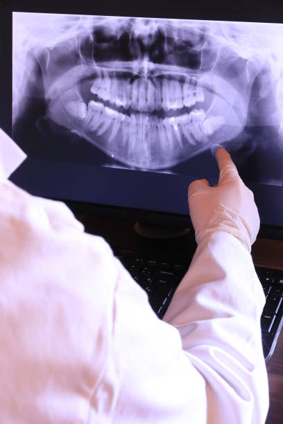 Best Knocked-Out Tooth (Avulsed Tooth) Treatment in Fairlea, WV